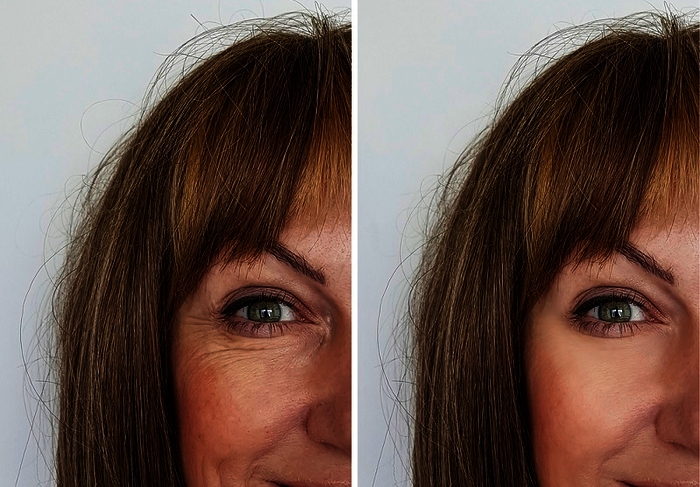 inno gialuron opiniones 